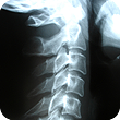 St Pete Chiropractor X-Rays