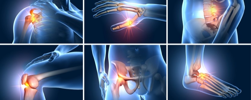 Joint Pain