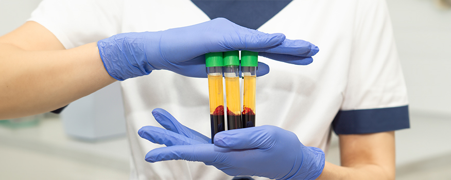 Platelet-rich Plasma