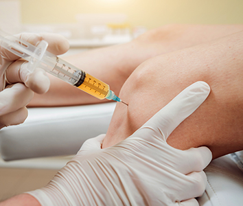 prp therapy in st petersburg
