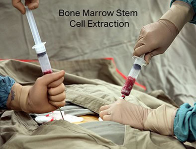 stem cells in st pete