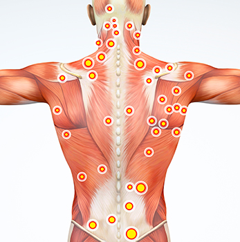 what are trigger points in st petersburg