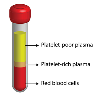what is prp in st petersburg